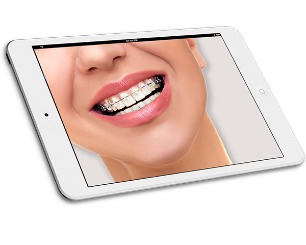 Ортодонтия 